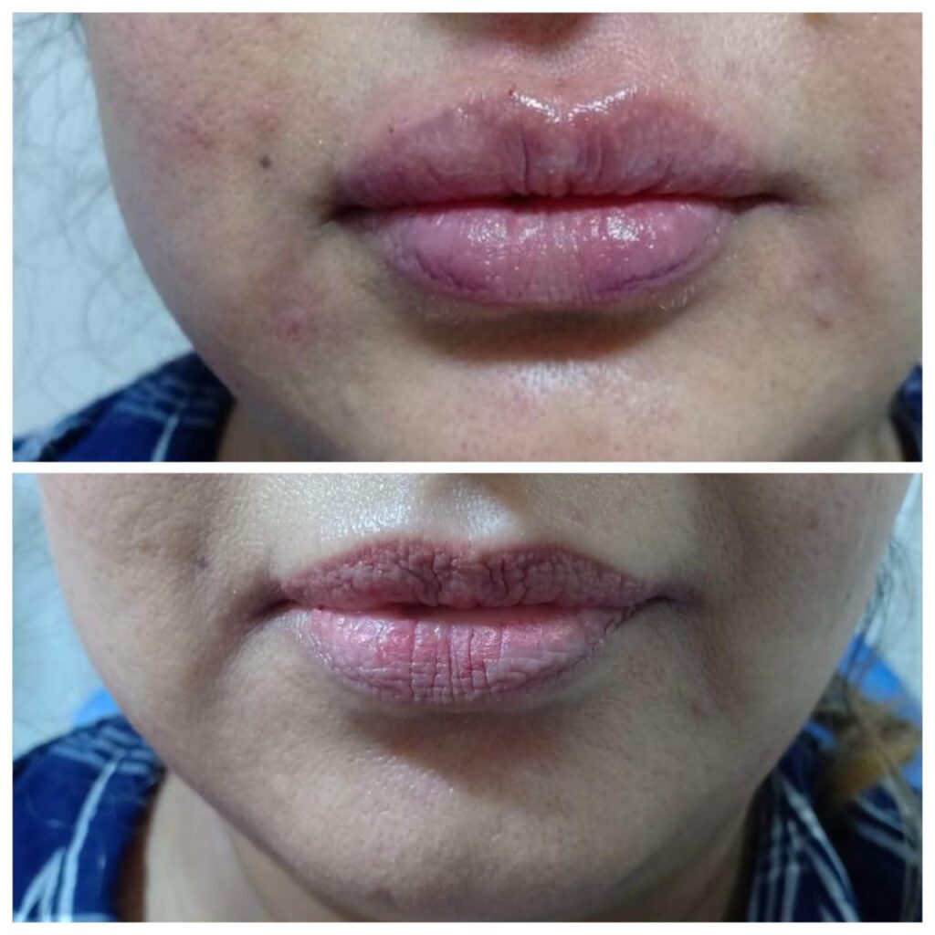 أفضل أطباء حقن الهيالورونيك في الغردقة